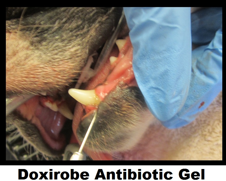 Doxirobe_Antibiotic_Gel